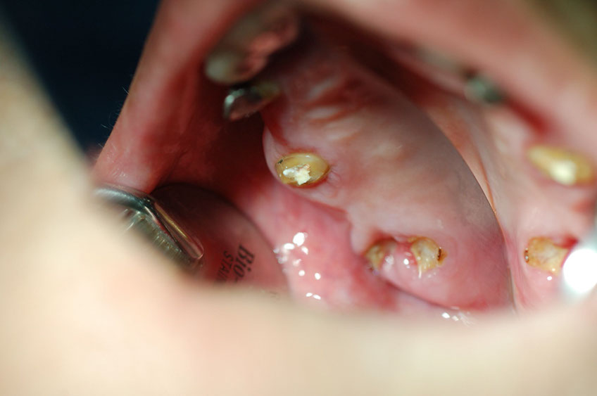 %_tempFileNameImplant%2024a1%