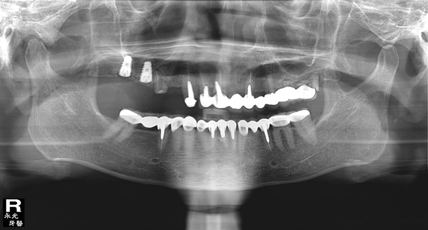 %_tempFileNameImplant%2024e2%