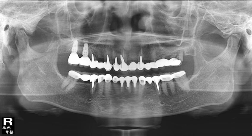%_tempFileNameImplant%2024e5%
