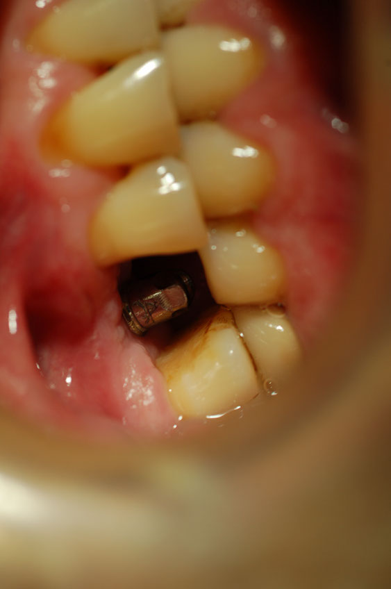 %_tempFileNameImplant%2025c%