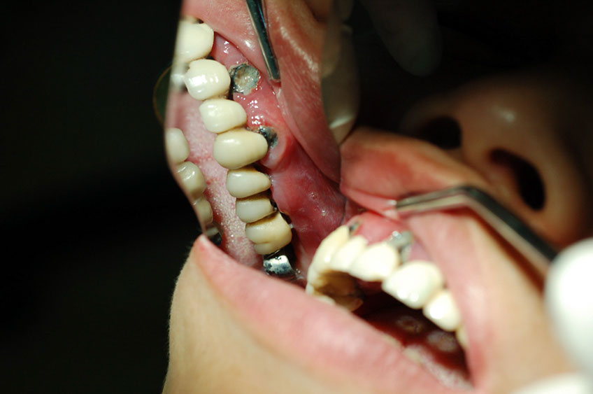 %_tempFileNameImplant%2026a2%