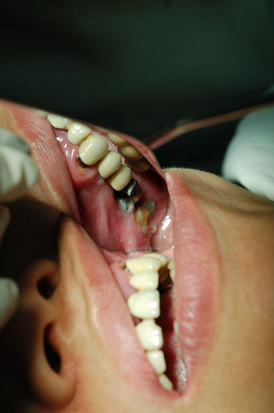 %_tempFileNameImplant%2026a3%