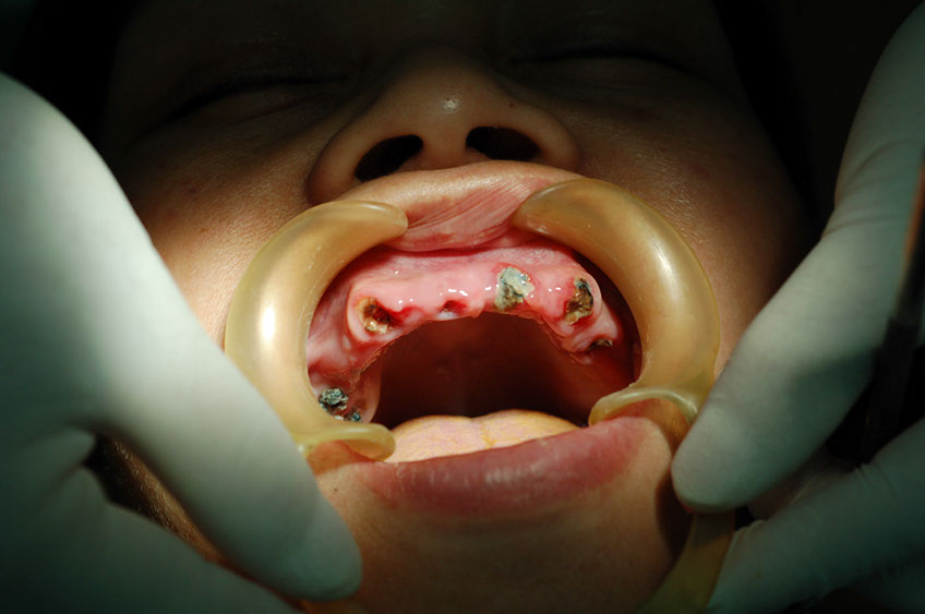 %_tempFileNameImplant%2026ab1%