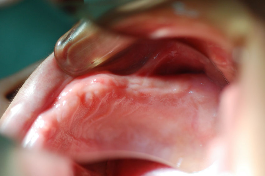 %_tempFileNameImplant%2026b2%