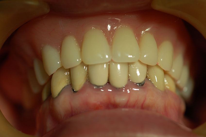 %_tempFileNameImplant%2026b3%