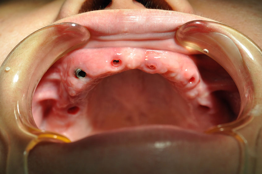 %_tempFileNameImplant%2026b4%
