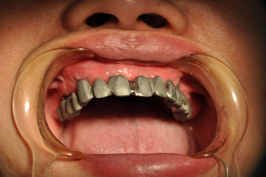 %_tempFileNameImplant%2026b6%