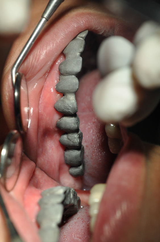 %_tempFileNameImplant%2026b8%