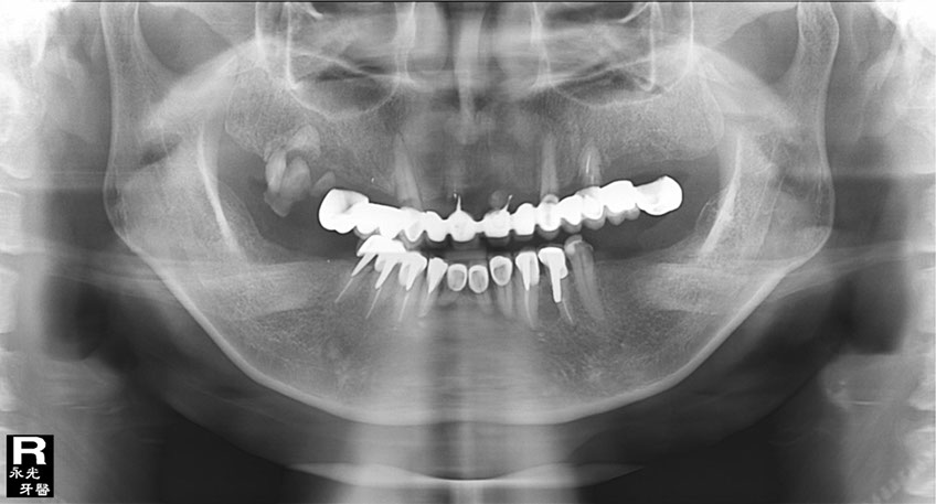 %_tempFileNameImplant%2026f1%