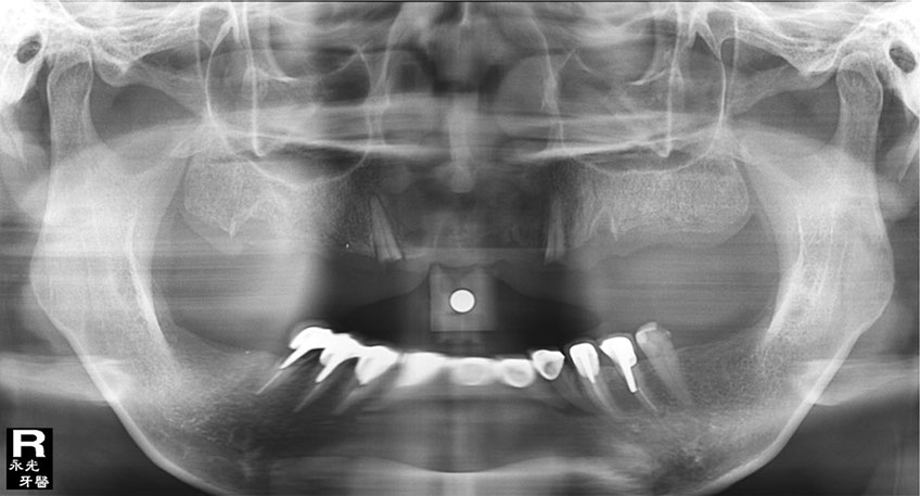 %_tempFileNameImplant%2026f2%