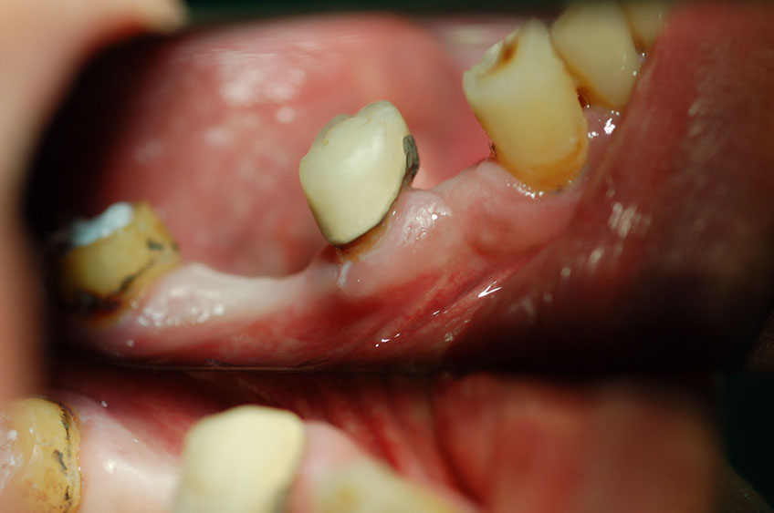 %_tempFileNameImplant%2027a1%