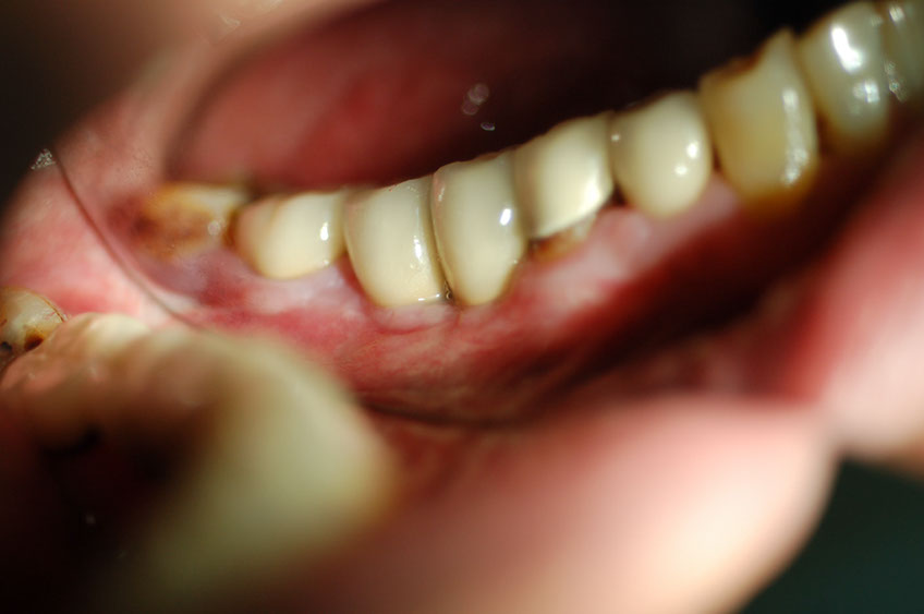 %_tempFileNameImplant%2027a3%