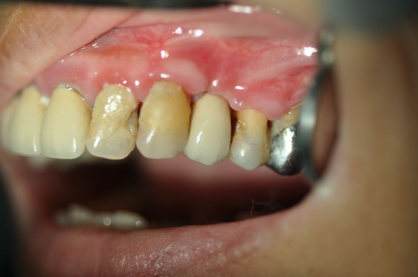 %_tempFileNameImplant%2028c1%