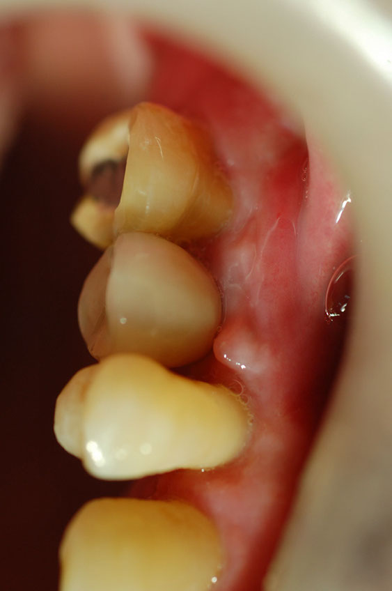 %_tempFileNameImplant%2029c%