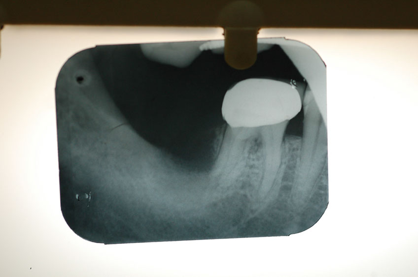 %_tempFileNameImplant%202b1%