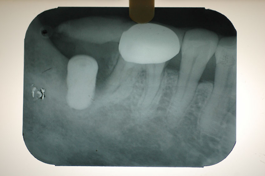 %_tempFileNameImplant%202b2%
