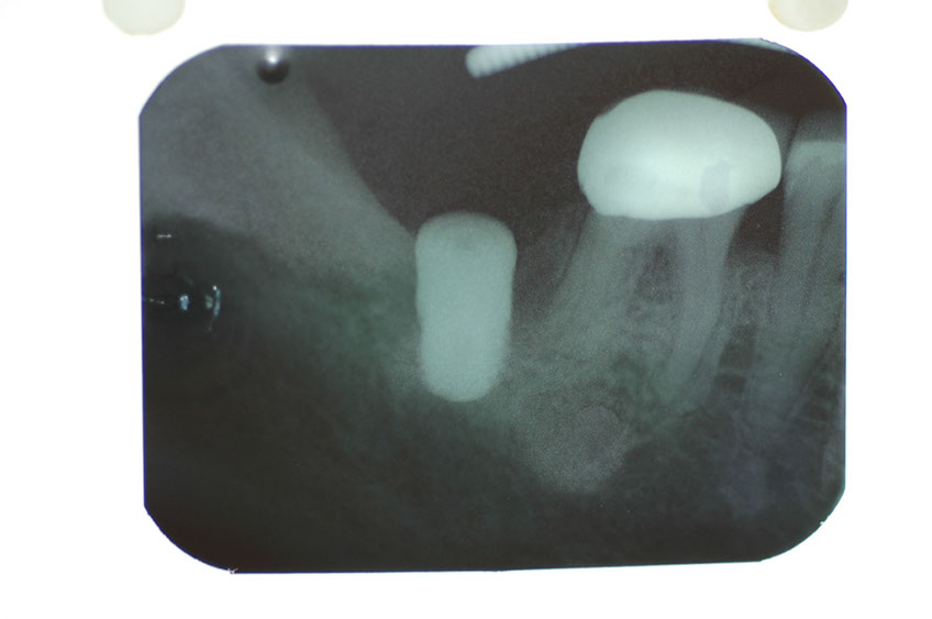 %_tempFileNameImplant%202e%