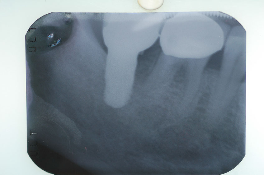 %_tempFileNameImplant%202f1%
