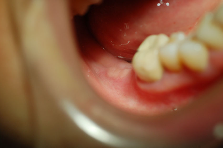 %_tempFileNameImplant%202g%