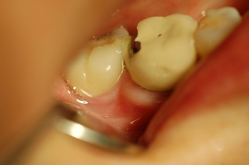 %_tempFileNameImplant%202p2%