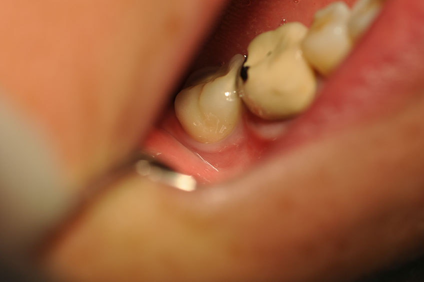 %_tempFileNameImplant%202p5%