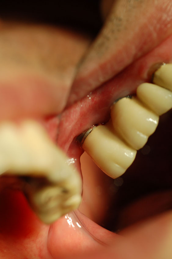 %_tempFileNameImplant%202r6%
