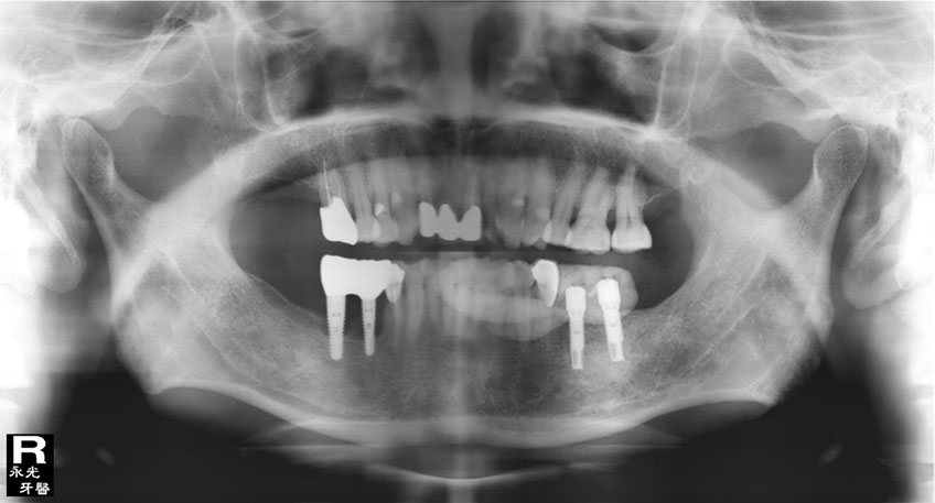 %_tempFileNameImplant%202s4%