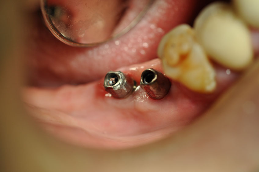 %_tempFileNameImplant%2030b%
