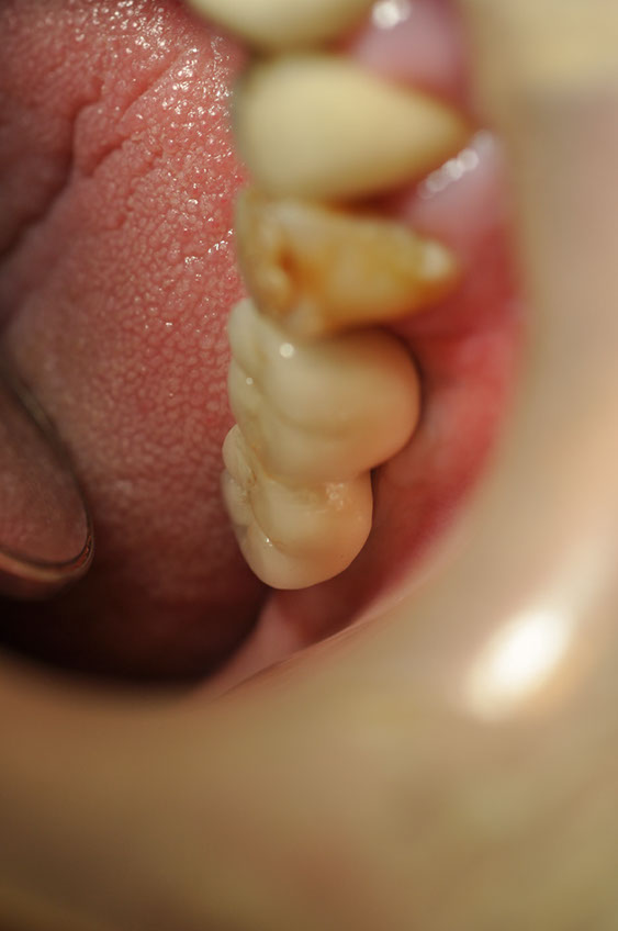 %_tempFileNameImplant%2030c%
