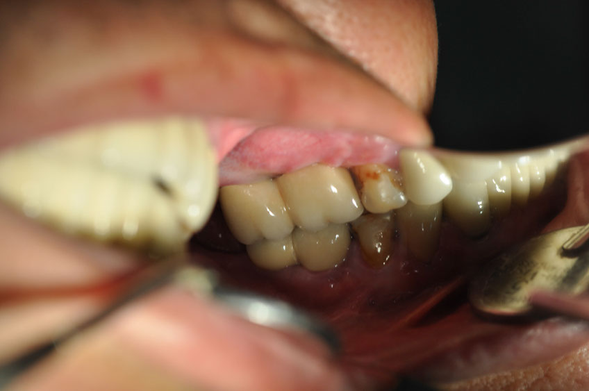 %_tempFileNameImplant%2030f%