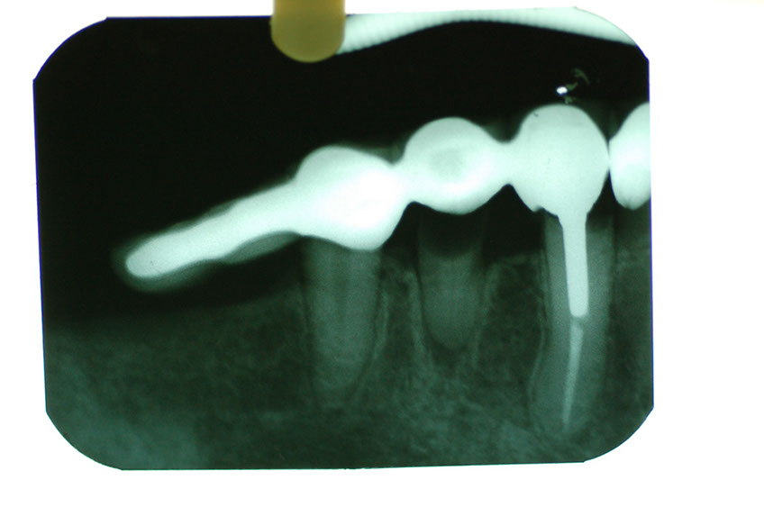 %_tempFileNameImplant%2031c%