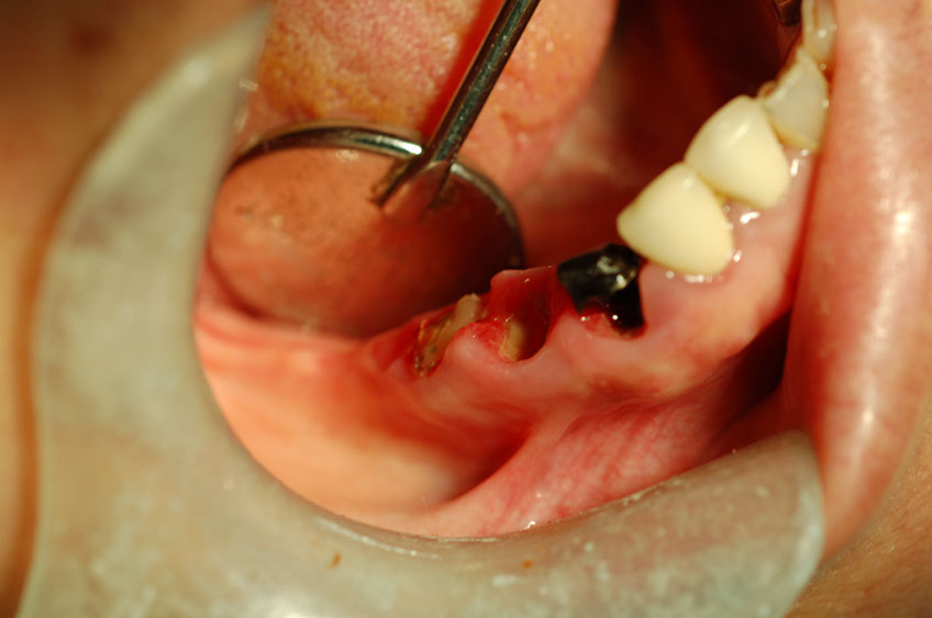 %_tempFileNameImplant%2031d%