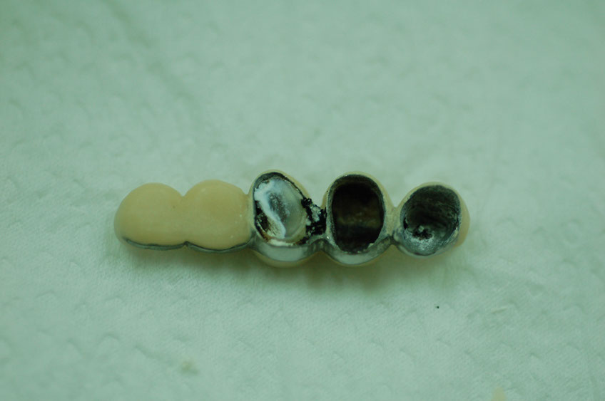 %_tempFileNameImplant%2031e%