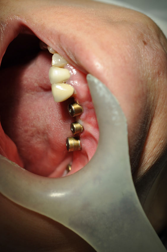 %_tempFileNameImplant%2031h1%