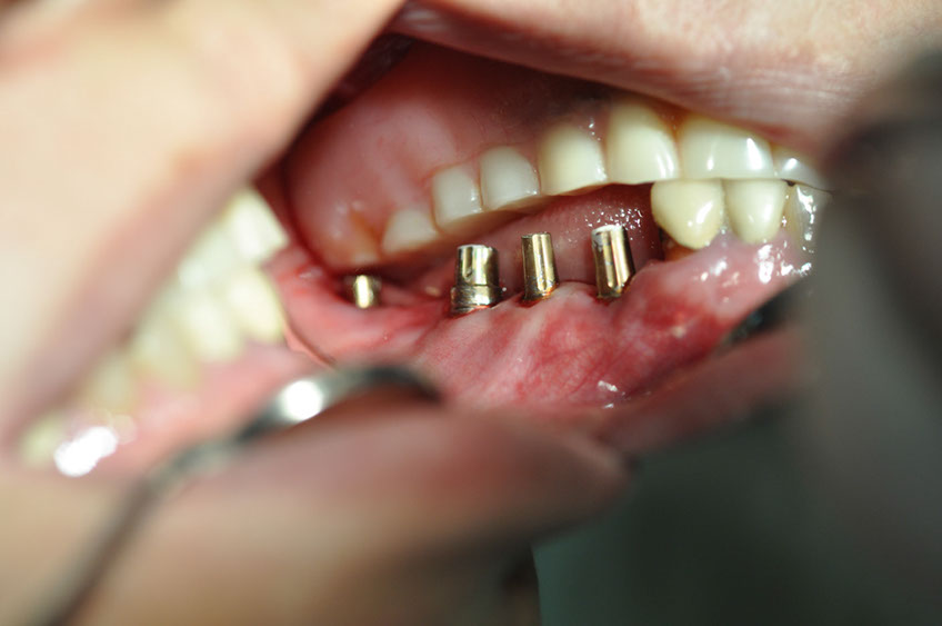 %_tempFileNameImplant%2031h3%