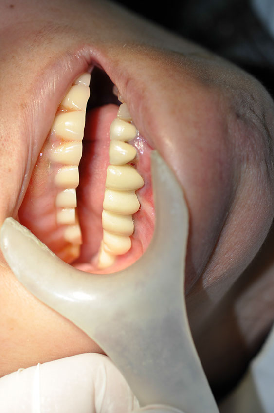 %_tempFileNameImplant%2031i%