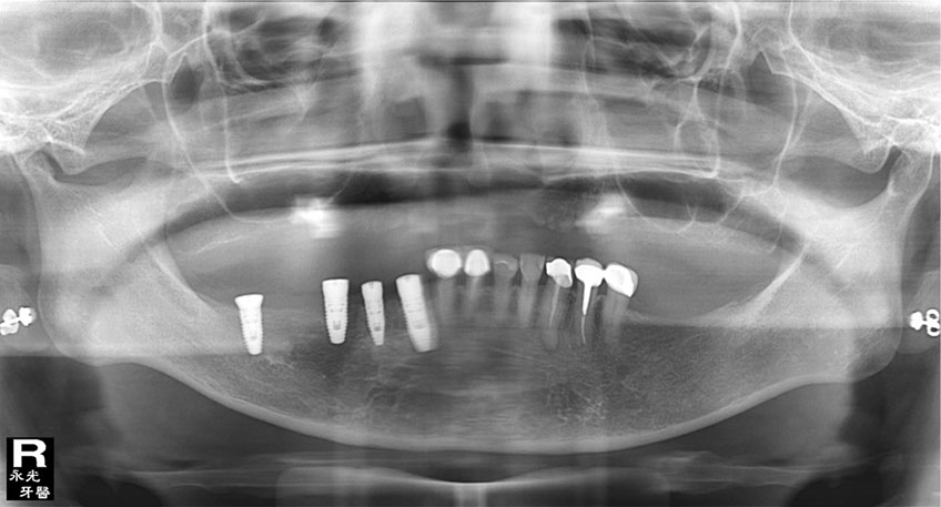 %_tempFileNameImplant%2031k3%