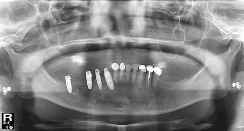 %_tempFileNameImplant%2031k4%