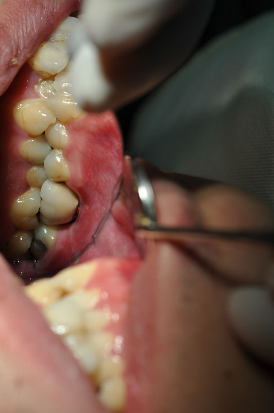 %_tempFileNameImplant%2032La7%
