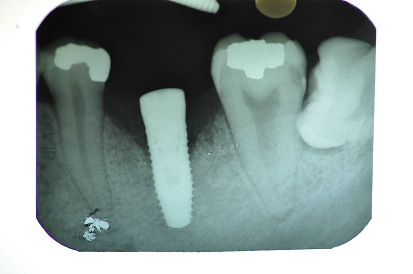 %_tempFileNameImplant%2032Lb2%