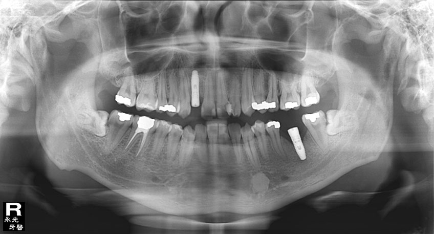 %_tempFileNameImplant%2032Lc3%