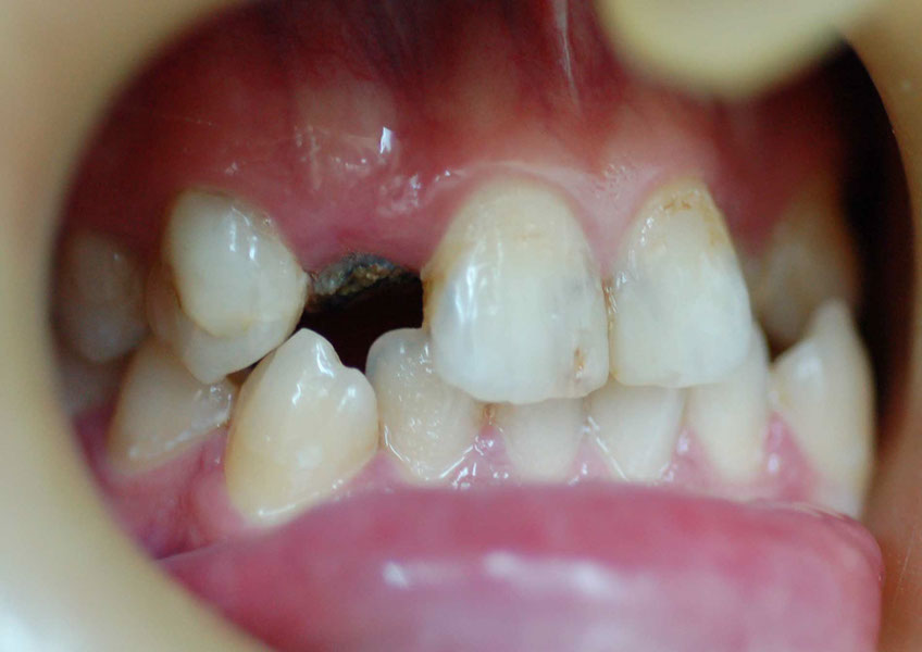 %_tempFileNameImplant%2032a1%