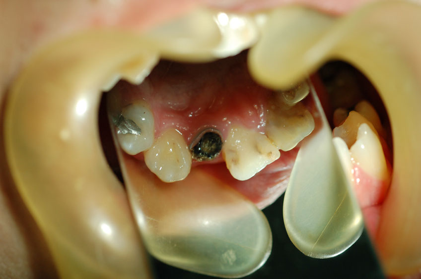 %_tempFileNameImplant%2032a2%