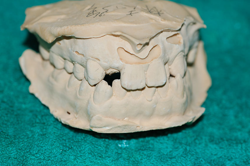 %_tempFileNameImplant%2032b1%