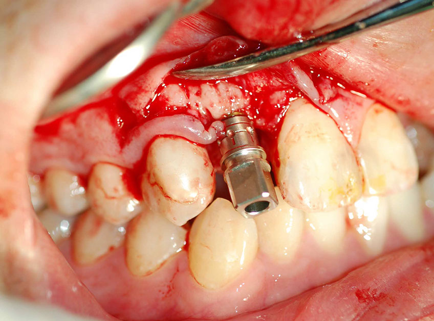 %_tempFileNameImplant%2032c1%