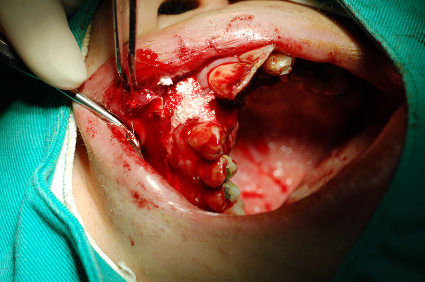 %_tempFileNameImplant%2032c3%