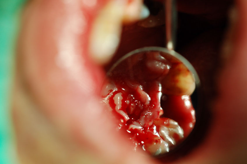 %_tempFileNameImplant%2032d2%