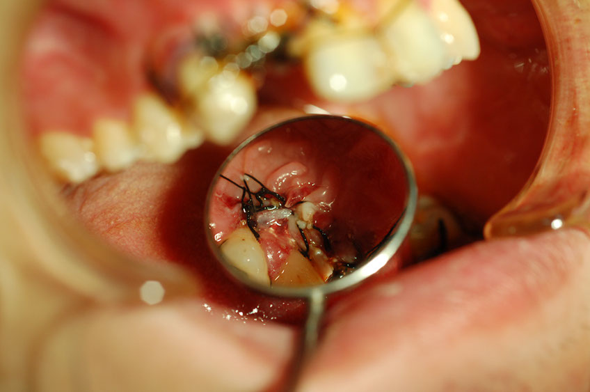 %_tempFileNameImplant%2032d3%