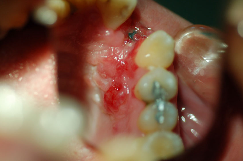 %_tempFileNameImplant%2032d4%