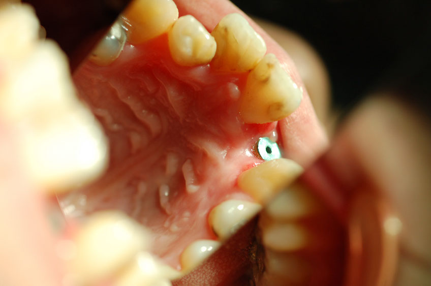 %_tempFileNameImplant%2032d5%